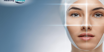 The Turkish Touch in Advanced Facelift Procedures